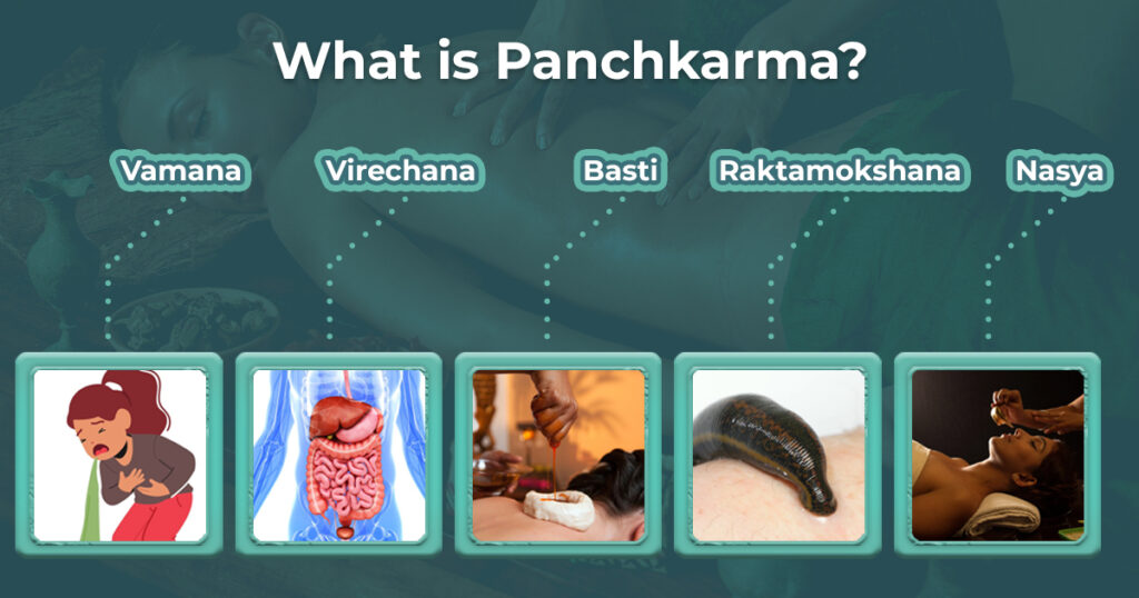 What is Panchkarma